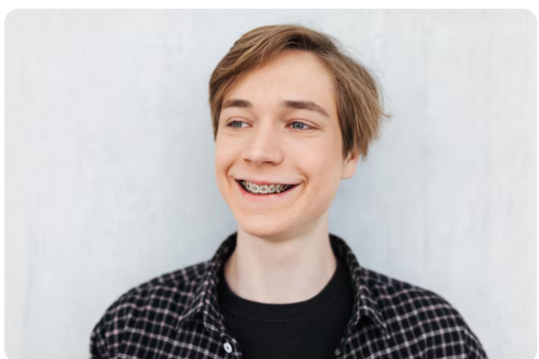 how to take care of your teeth after a braces 